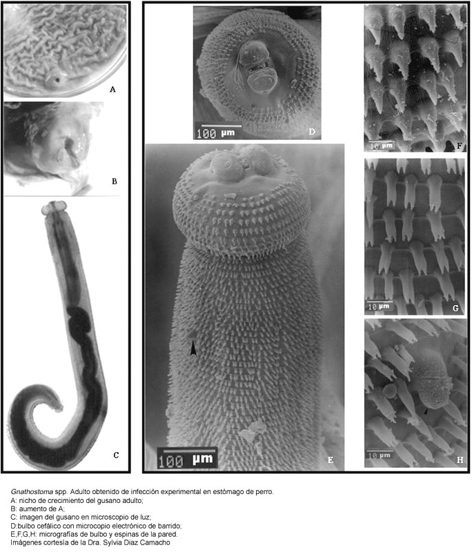 Gnatostoma binucleatum Gnathostomiasis
